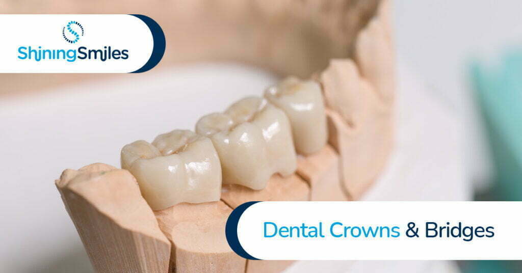 Marietta dental crown and bridge services.